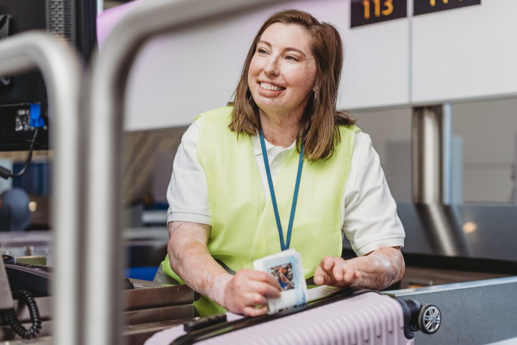 Airport worker with scarring and a limb difference smiles as she tags a suitcase at check-in.